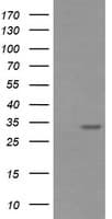 Monoclonal Mouse anti-Human RARRES1 Antibody (clone OTI1B1, IHC, WB)