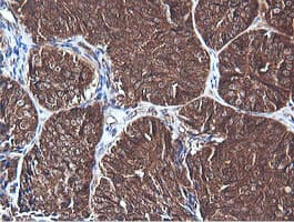 PIK3C2B Antibody (clone OTI3B1)