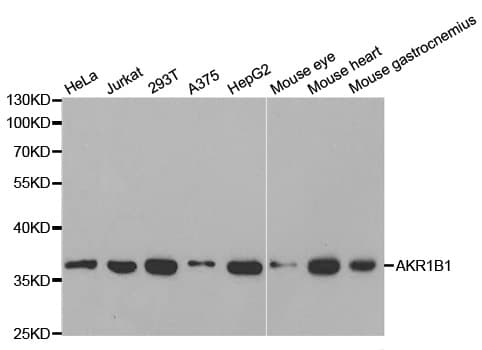 AKR1B1 / Aldose Reductase Antibody