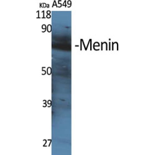 Polyclonal Rabbit anti-Human MEN1 / Menin Antibody (150-230 aa, Internal, IHC, WB)