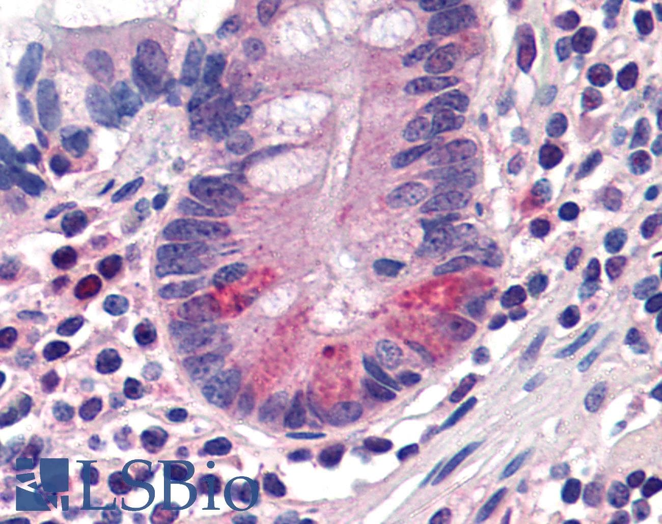 IHC-plus™ SLC15A1 / PEPT1 Antibody (C-Terminus)