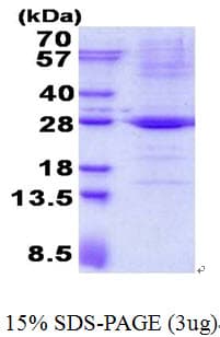 Human TRAPPC4 / Synbindin Protein (Recombinant His)