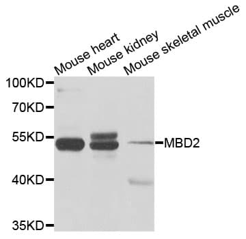 MBD2 Antibody