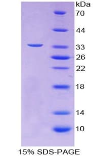 Human GP1BA / CD42b Protein (Recombinant His, N-terminus)