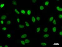 Monoclonal Mouse anti-Human HEXIM1 Antibody (clone 2416C2a, IF, WB)