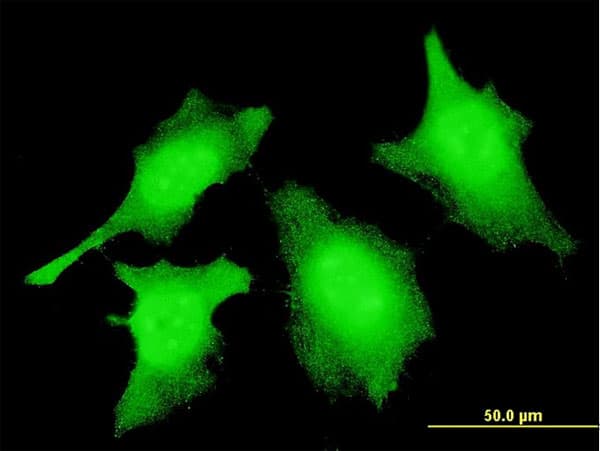 CASP2 / Caspase 2 Antibody (clone 1C11)