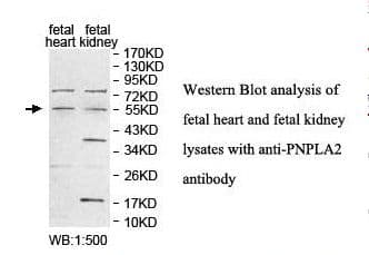 Polyclonal Rabbit anti-Human PNPLA2 / ATGL Antibody (aa122-340, IHC, WB)