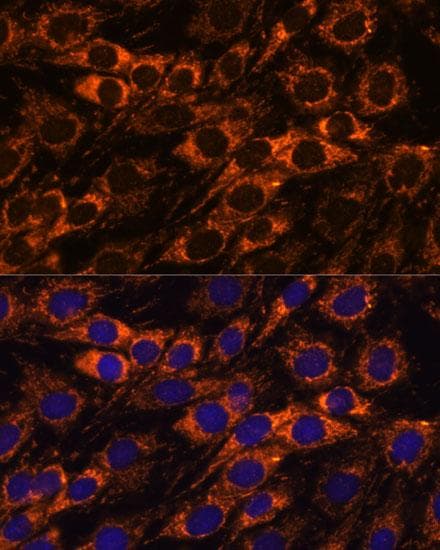 ACAA2 Antibody