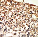 Polyclonal Rabbit anti-Human PRKACA + PRKACB Antibody (aa9-40, IHC, WB)