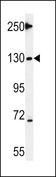 Polyclonal Rabbit anti-Human TANK2 / TNKS2 Antibody (aa1126-1156, WB)