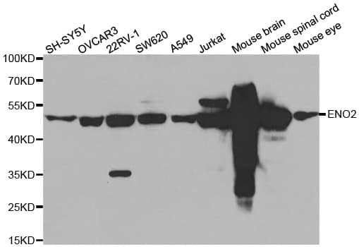 ENO2 / NSE Antibody