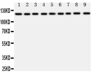 TRPC3 Antibody (aa836-851)