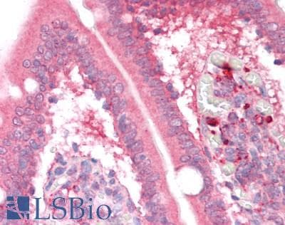 PathPlus™ FGF19 Antibody