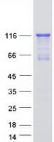 Human MRVI1 Protein (Recombinant Myc-DDK (Flag))