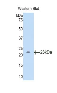 LCAT Antibody (aa41-210, PE)