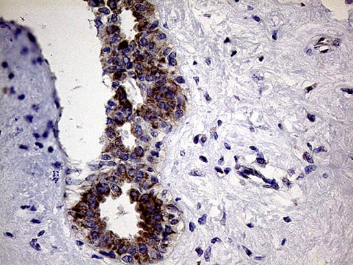 Monoclonal Mouse anti-Human CLIP4 / RSNL2 Antibody (clone OTI5D10, IHC, WB)