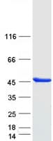 Human PSMD6 Protein (Recombinant Myc-DDK (Flag))