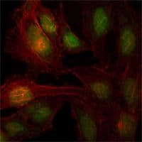 ZBTB7B / HcKrox Antibody (clone 7C12)