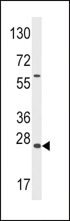 IHC-plus™ GADD45A / GADD45 Antibody (aa1-30)