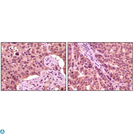 GSK3A / GSK3 Alpha Antibody