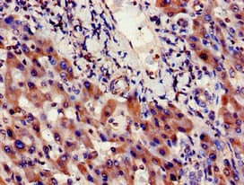 Polyclonal Rabbit anti-Human INSIG1 Antibody (IHC, IF, WB)