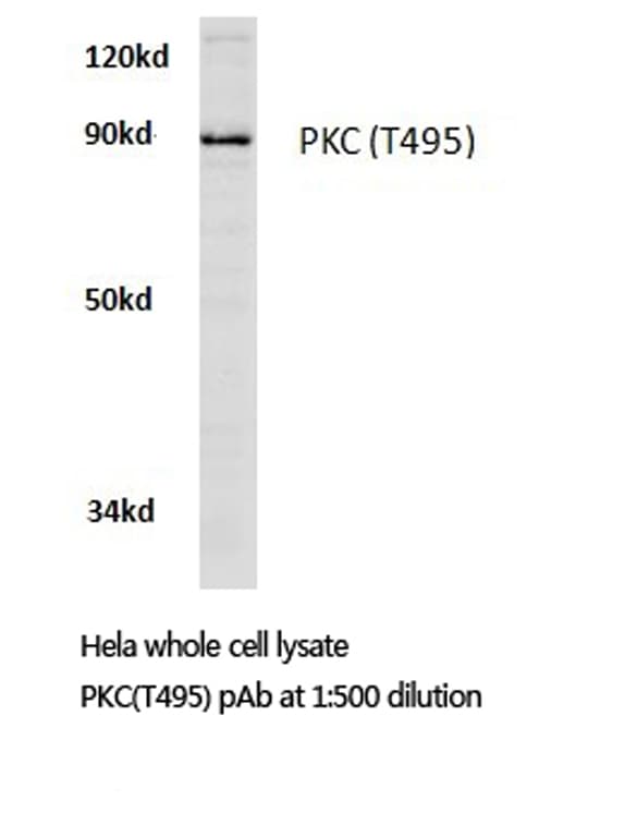 Polyclonal Rabbit anti-Human PKC / Protein Kinase C Antibody (Thr495, IHC, IF, WB)