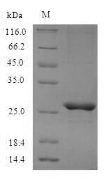 Mouse Mcpt4 Protein (Recombinant 6His, N-terminus)
