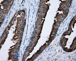 PRKAR2A Antibody (clone OTI1B4)