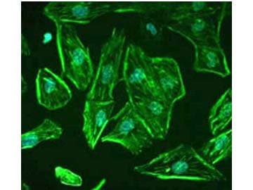 IHC-plus™ ROBO1 Antibody (aa1625-1650)