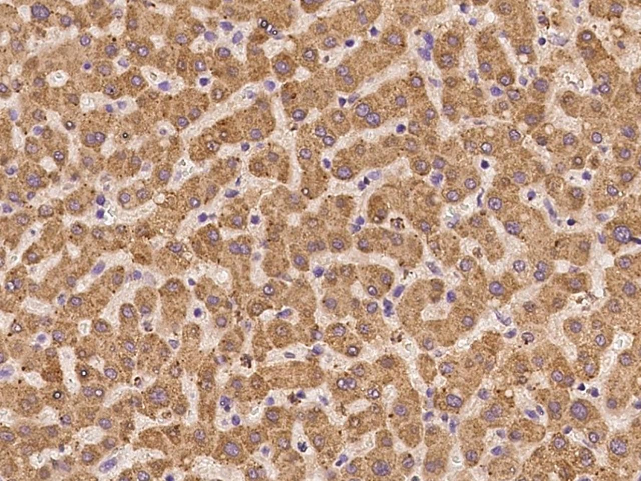 GGCX Antibody