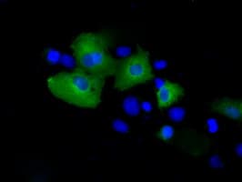 PSMC3 Antibody (clone OTI10D12)