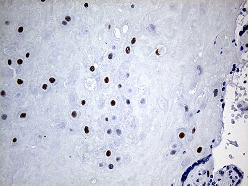 KLF5 / BTEB2 Antibody (aa1-457, clone OTI2G4, Carrier-free)