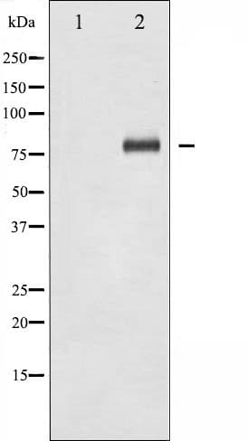 FOXO1 / FKHR Antibody (phospho-Ser329)