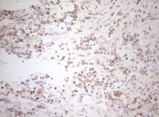 DECR1 Antibody (clone OTI7B11)