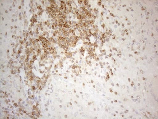 BCL2 / Bcl-2 Antibody (clone UMAB225, Carrier-free)