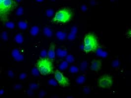 Monoclonal Mouse anti-Human CYP2E1 Antibody (clone OTI9E6, IHC, IF, WB)