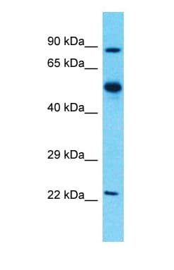 ALDH1A1 / ALDH1 Antibody (N-Terminus)