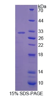 Human IFI30 / IP30 Protein (Recombinant His-T7)