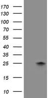 FXN / Frataxin Antibody (clone OTI3B6)
