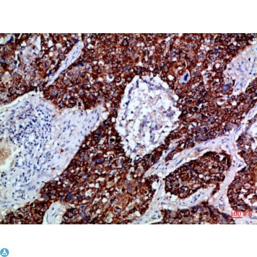 Polyclonal Rabbit anti-Human EPHB3 / EPH Receptor B3 Antibody (WB)