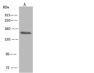 CR2 / CD21 Antibody