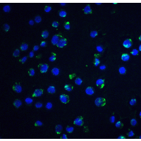 PathPlus™ Polyclonal Rabbit anti-Human ACIN1 / Acinus Antibody (IHC, IF, WB)