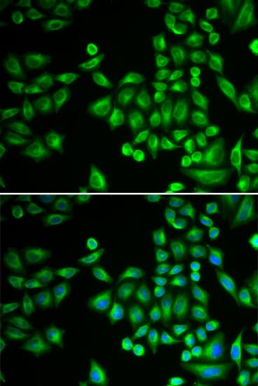 PTP1B Antibody