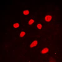 IHC-plus™ CTBP2 Antibody (C-Terminus)