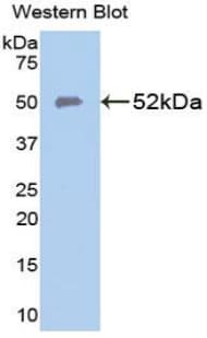 SLC40A1 / Ferroportin-1 Antibody (aa127-321)