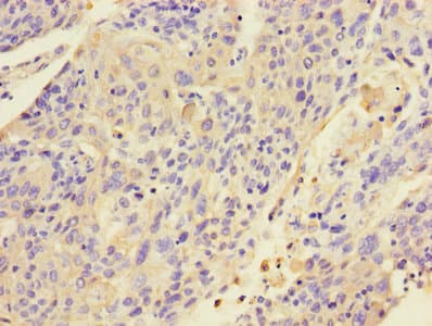 Polyclonal Rabbit anti-Human KRT4 / CK4 / Cytokeratin 4 Antibody (WB)