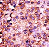 PANK3 Antibody (aa1-30)