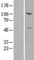 IFT52 Protein (Over-Expression Lysate Myc-DDK (Flag))