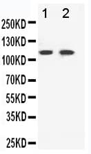 Polyclonal Rabbit anti-Human EPHB3 / EPH Receptor B3 Antibody (aa982-998, IHC, WB)