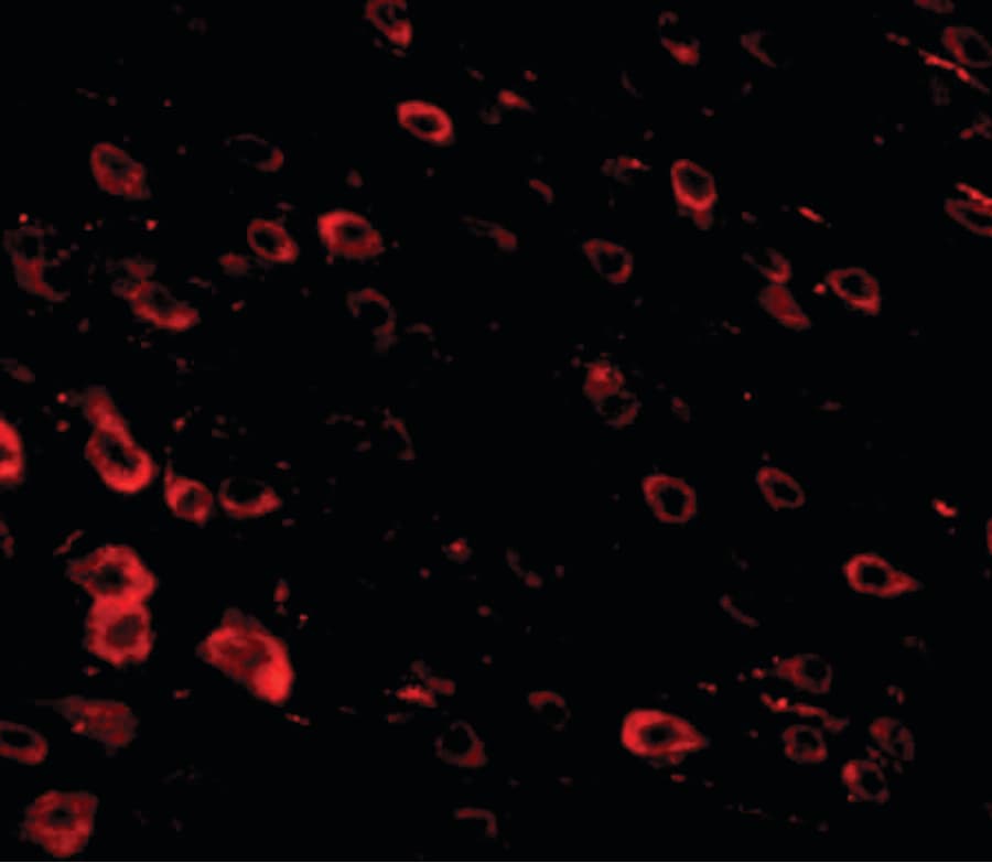 IHC-plus™ LRFN3 Antibody